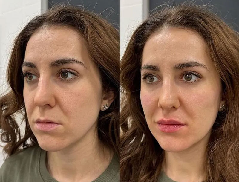 dr-christian-zapata-Cómo-rejuvenecer-sin-perder-tu-esencia-armonizacion-facial-1